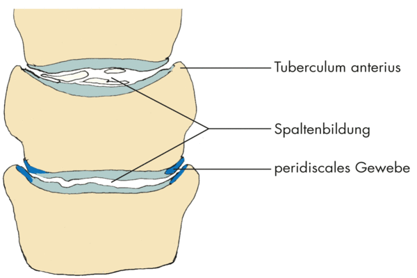 Abb. 4.6: Unkovertebralgelenke